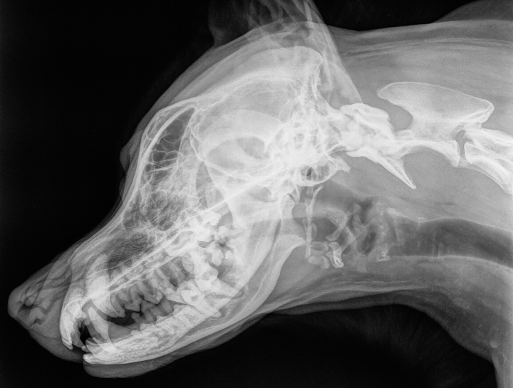 Dental Xray